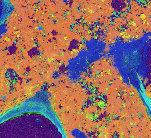 biomaterial degradation